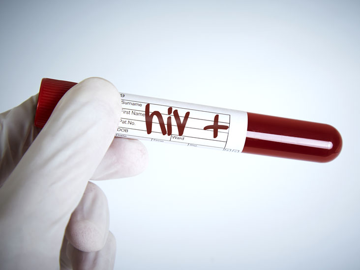 hiv-aids-seroconversion-time_thumb