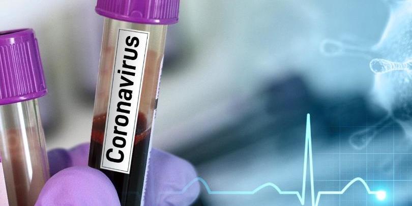 Coronavirus+test+MGN-5e6dff85badd6-5e7328c00854c