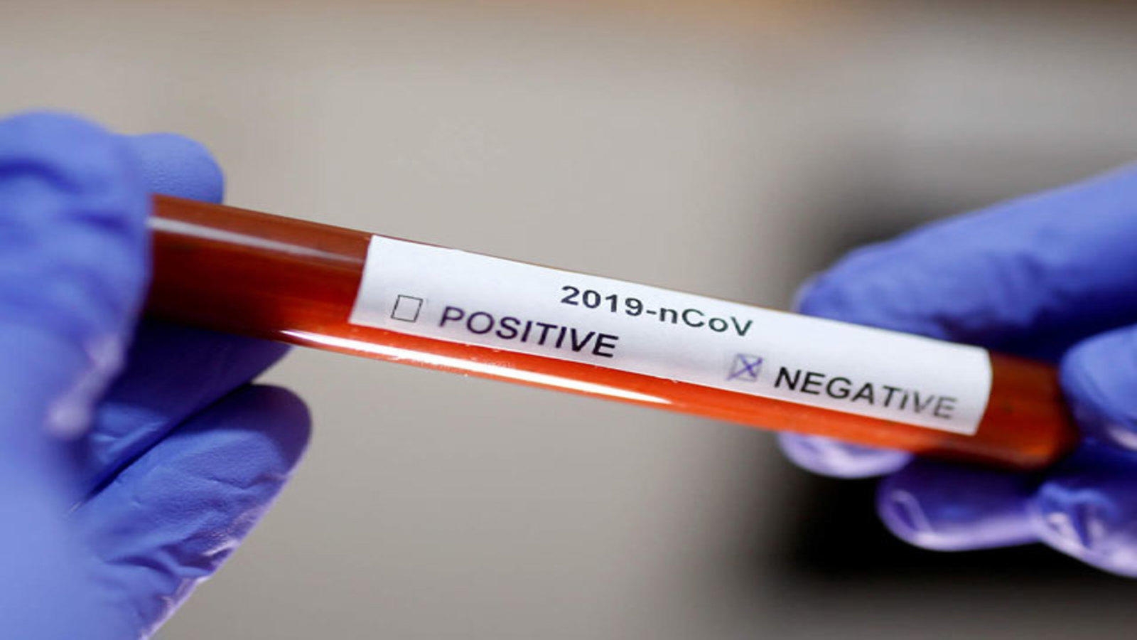 1585821683-coronavirus-outbreak-6-samples-from-noida-test-negative