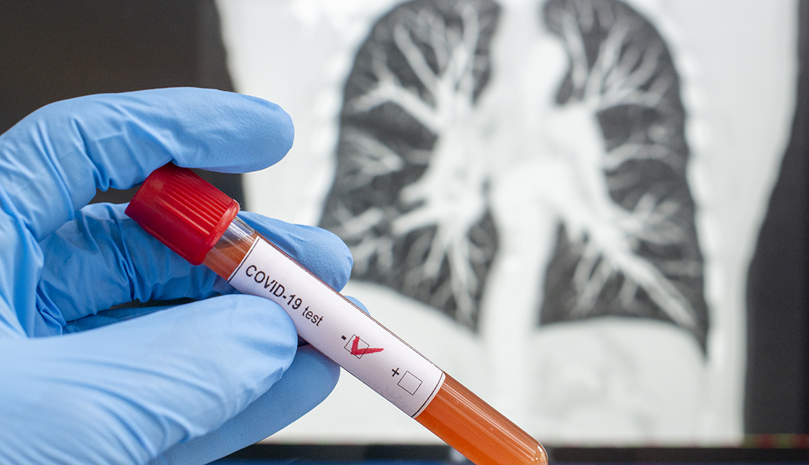 Hand holding a vial with a COVID0-19 test that is a negative. A lung scan appears in the background