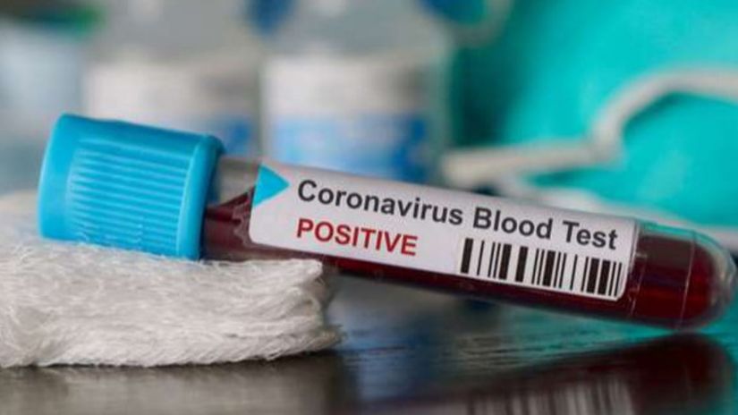 koronavirusi-w-h koronavirusi-w-h