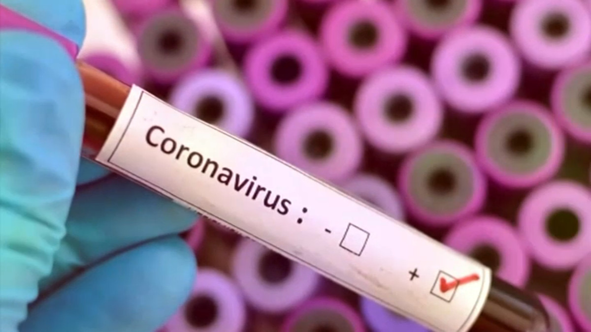 Coronavirus-file-2