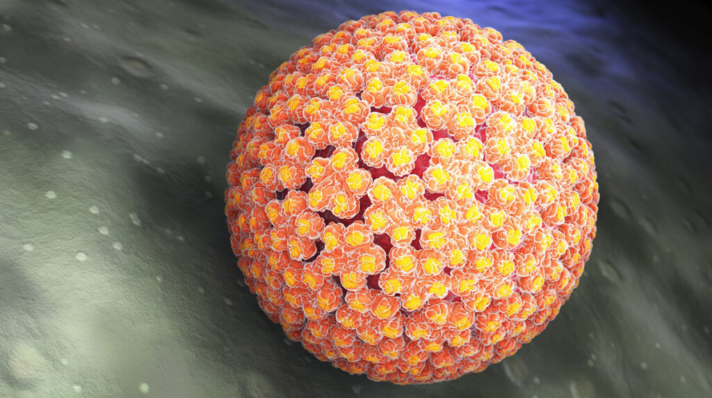 პაპილომა ვირუსი