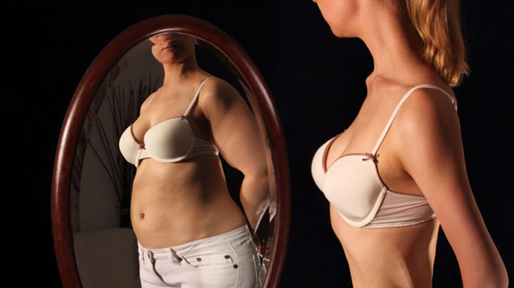 ანორექსია