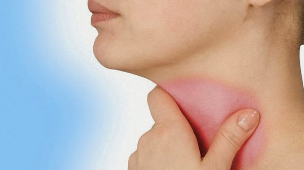 ლარინგიტი