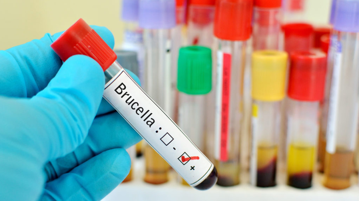 ბრუცელოზი